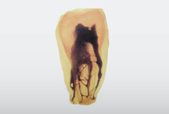 病気とは体内に遺物が存在することである。 自然療法家 ルイス・キューネ*